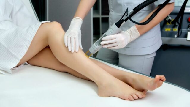 激光脱毛：告别烦恼的秘密武器