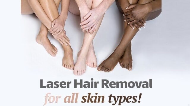 Say Goodbye to Shaving: Unveiling the Magic of Laser Hair Removal