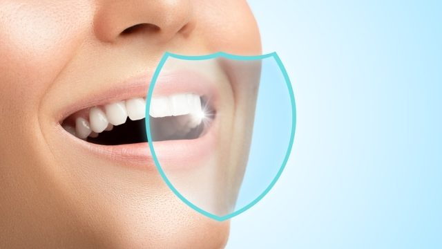 Shining Smiles: Unveiling the Secrets of Teeth Whitening